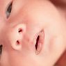 5 Cara Mengatasi Bibir Kering pada Bayi
