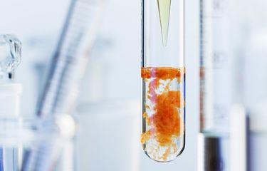 Electron didapatkan dari reaksi oksidasi namun hilang pada reaksi reduksi.