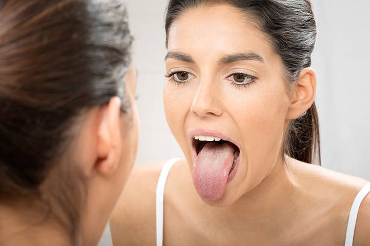 Ilustrasi lidah. Kondisi lidah dapat menjadi tanda stroke.