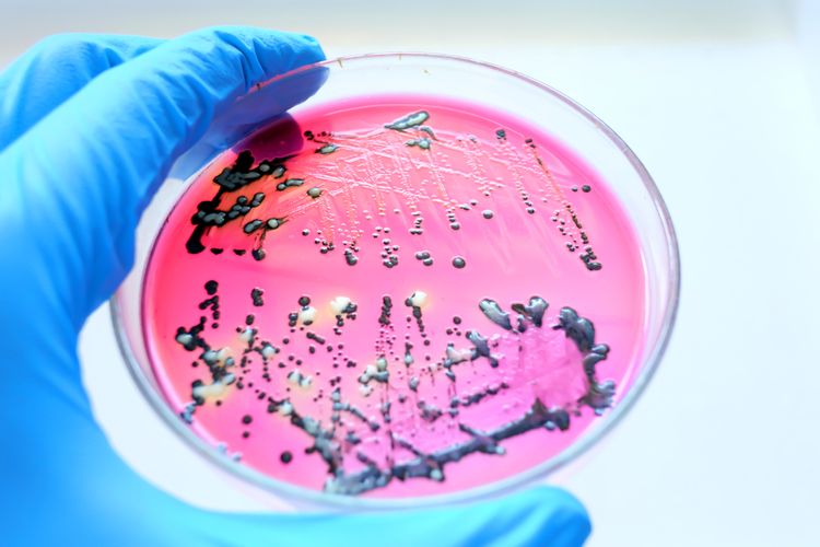 Ilustrasi bakteri Salmonella. Kuman penyakit ini termasuk dalam daftar salah satu bakteri paling berbahaya karena resisten dengan antibiotik menurut WHO. 