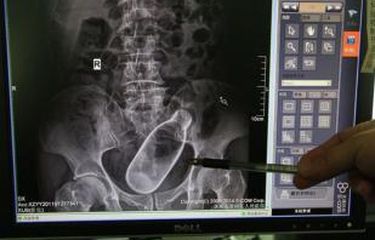 Ogil bolalar guruhi bilan porno Pioneer Leader pornosini tomosha qiling