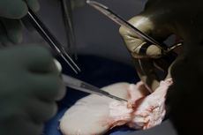 Kabar Baik Hasil Uji Coba Transplantasi Ginjal dari Babi ke Manusia oleh Ahli Bedah AS