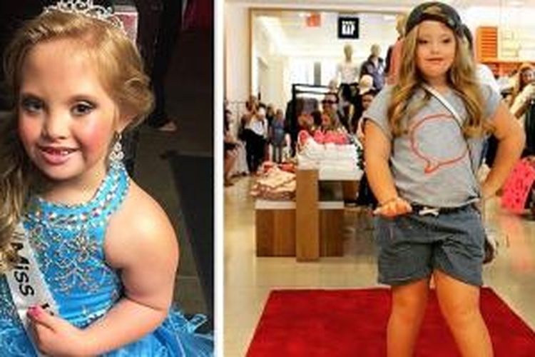 Model "Down Syndrome" Cilik Ini Jajal Peragaan Mode