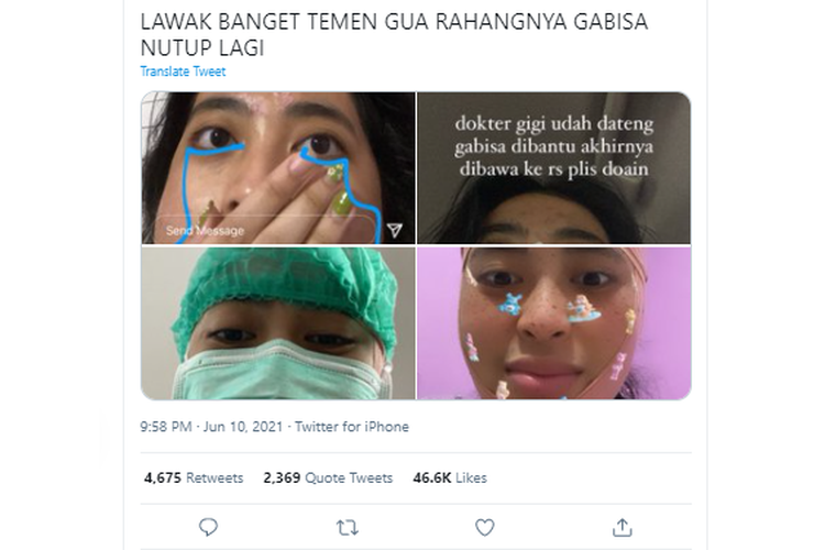 Twit yang membagikan pengalaman seseorang rahangnya tidak bisa menutup setelah menguap. Mengapa bisa terjadi? 