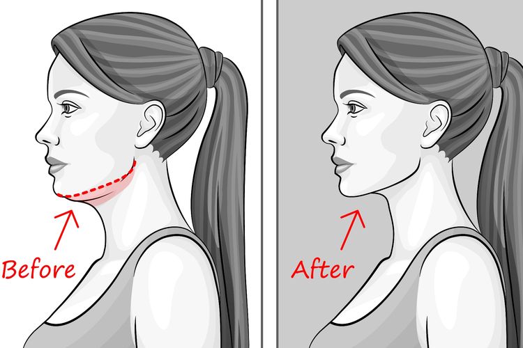 Membentuk Dagu Dan Rahang Tanpa Operasi Plastik Halaman All Kompas Com