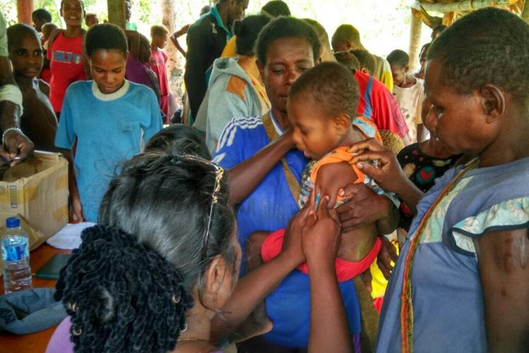 Penanganan medis terhadap anak-anak di Kabupaten Asmat.