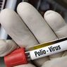 Anak 4 Tahun di Purwakarta Terkonfirmasi Polio, Dinkes Sebut Belum Diimunisasi
