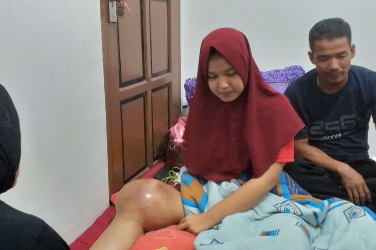 Riska Ramadila (17) siswi SMA di Kelurahan Lipat Kain, Kecamatan Kampar Kiri, Kabupaten Kampar, yang mengidap tumor ganas saat berada di rumah pamannya di Desa Kubang Jaya, Kecamatan Siak Hulu, Kampar, Riau, Minggu (2/2/2020).