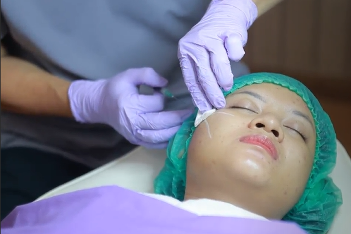Ilustrasi pasien menjalani Collagen Stimulator di Eva Mulia Clinic Tebet, Jakarta Selatan, Senin (10/6/2024)