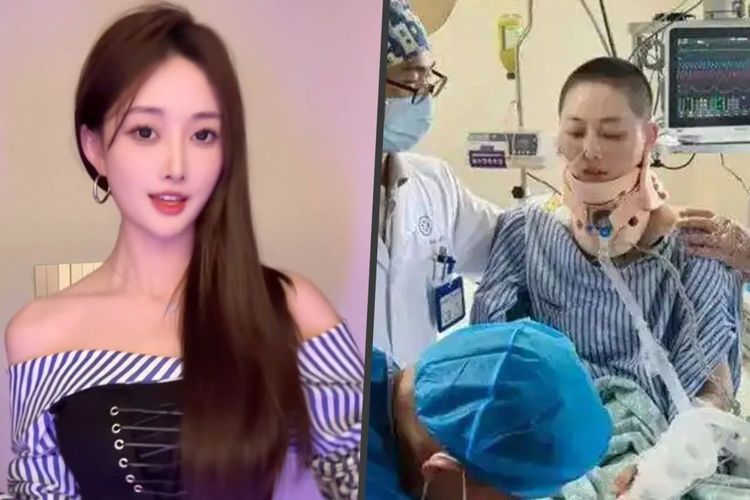 Influencer China Masih Hidup Usai Jatuh dari Lantai 35, Operasi 14 Jam