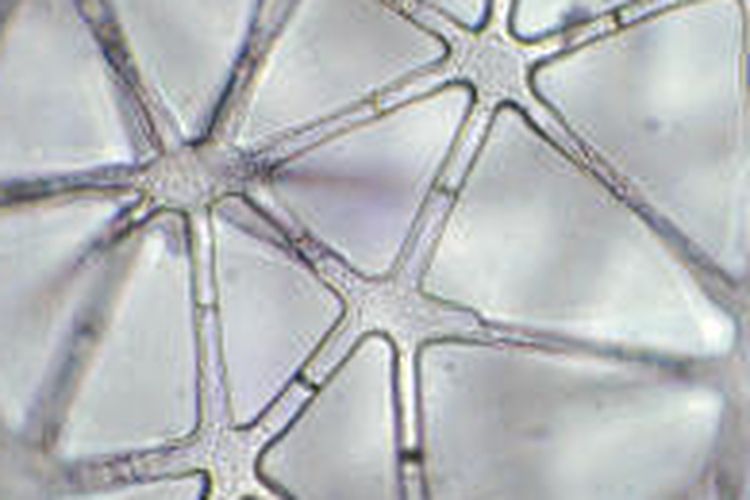 Jenis-jenis Jaringan Parenkim pada Tumbuhan