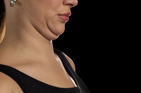 Catat, 6 Cara Menghilangkan Double Chin
