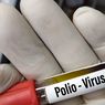 Ada Anak 4 Tahun Terjangkit Polio, Dinkes Purwakarta Gelar Imunisasi Massal