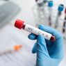 Dinkes: Hingga Maret 2022 Ada 13.670 Kasus HIV/AIDS di Banten