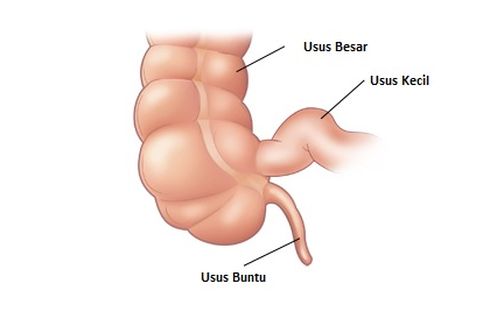 Benarkah Makanan Bisa Memicu Usus Buntu?