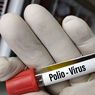 32 Provinsi di RI Masuk Kategori Risiko Tinggi Polio