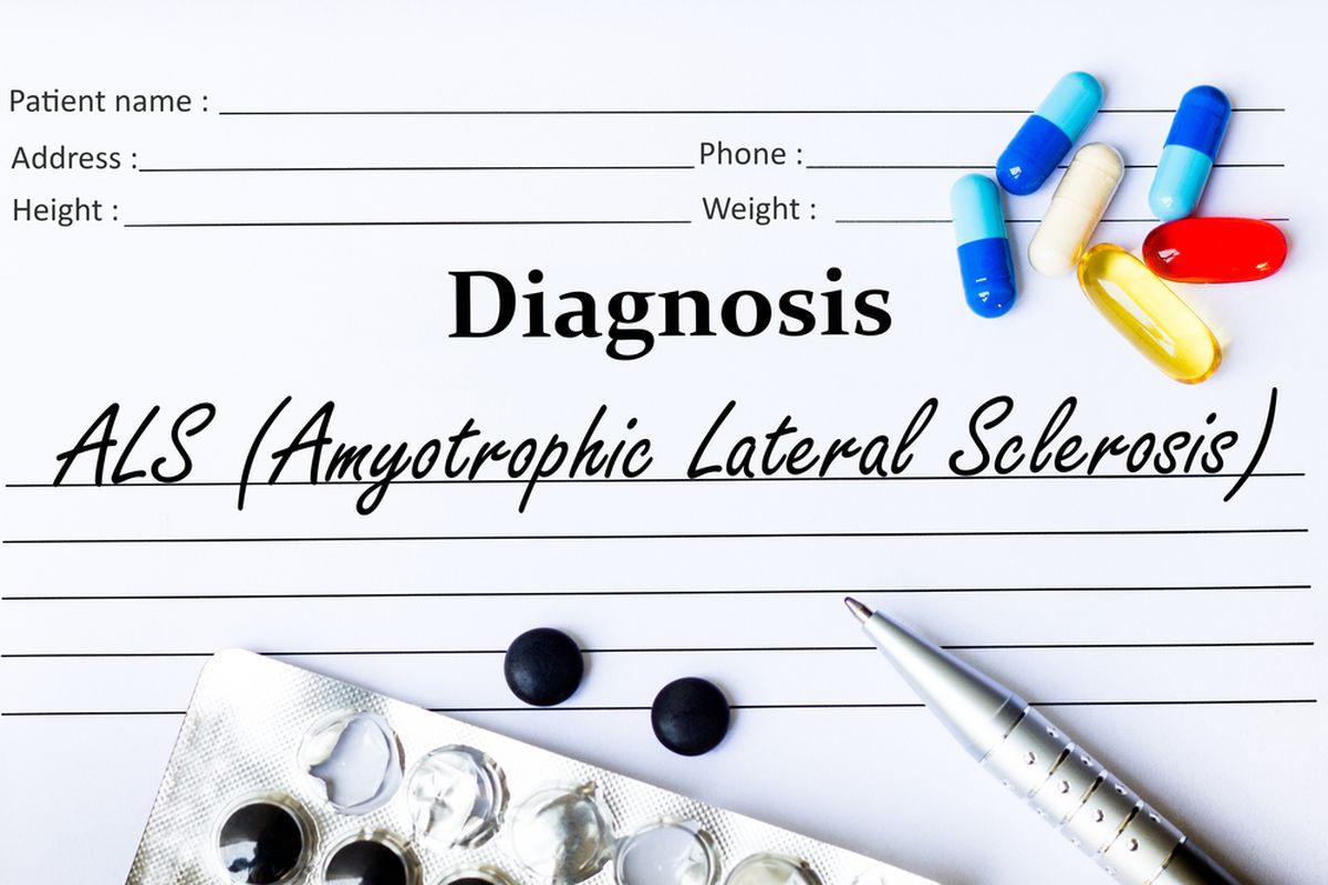 Ilustrasi Als (amyotrophic Lateral Sclerosis)