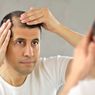Perawatan Rambut Rontok Khusus Pria untuk Mencegah Kebotakan