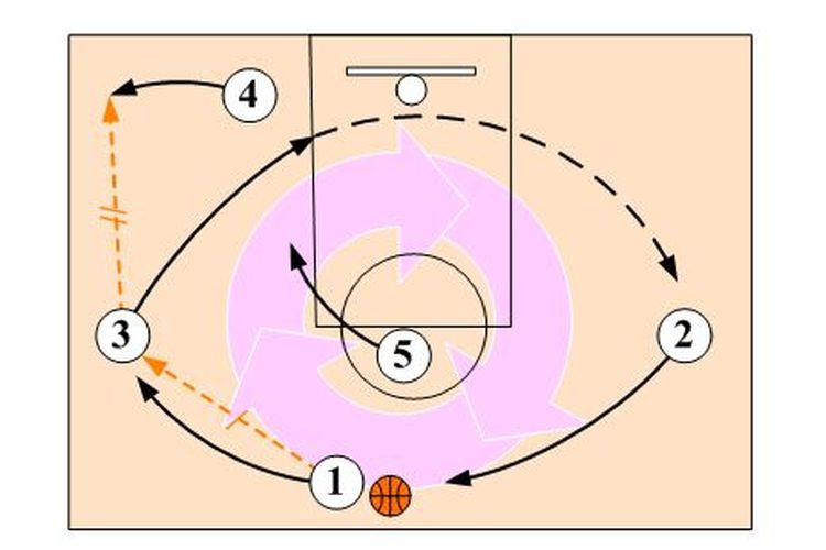Dalam permainan bola basket, pola penyerangan 1-3-1 disebut juga dengan istilah ...