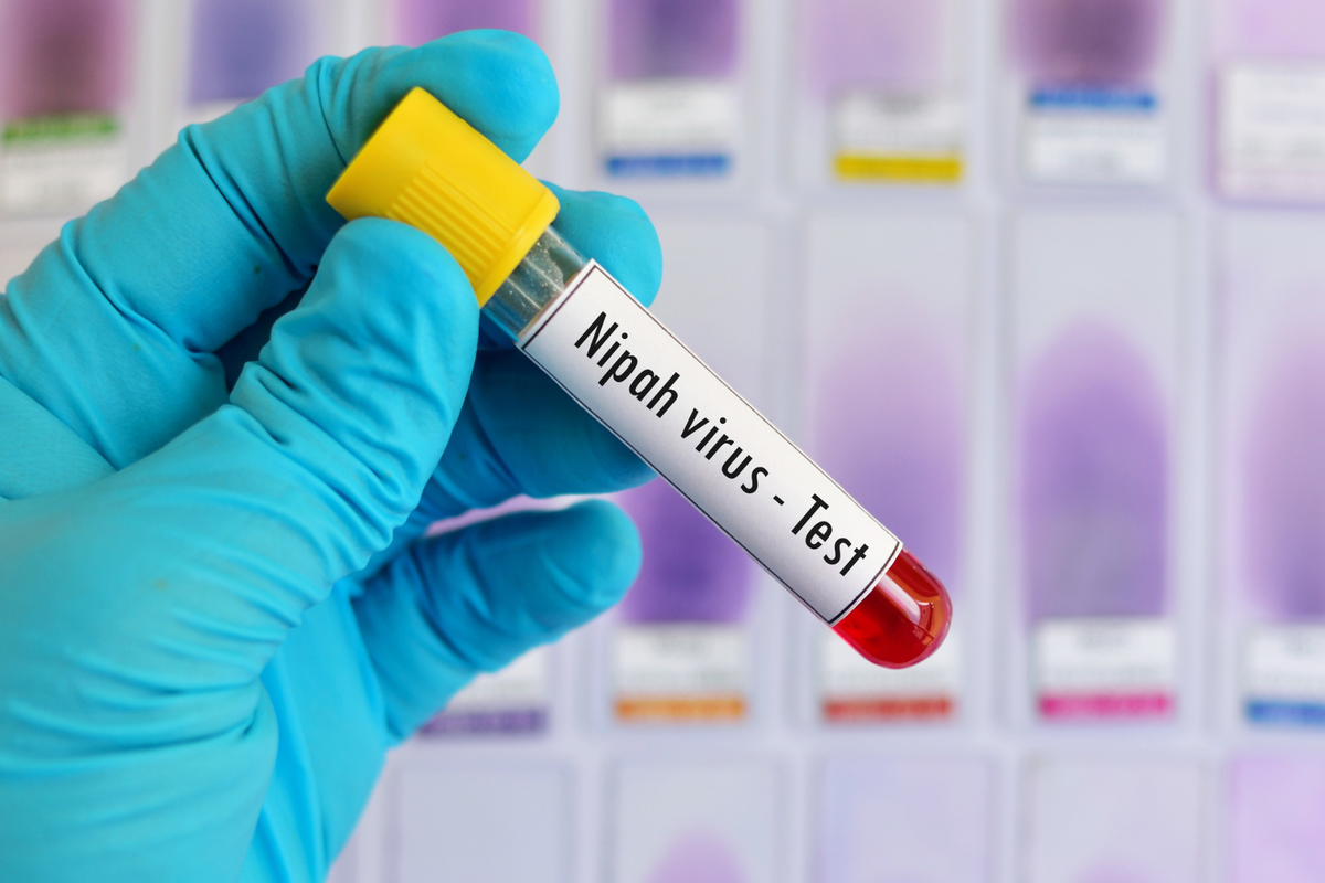 Virus Nipah sejauh ini belum ditemukan di Indonesia. Namun, BRIN mengingatkan deteksi dini dan surveilans untuk mencegah penyebaran virus. 