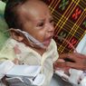Kisah Pilu Bayi Altrisno, Idap Bronkitis, Orangtua Tak Punya Biaya