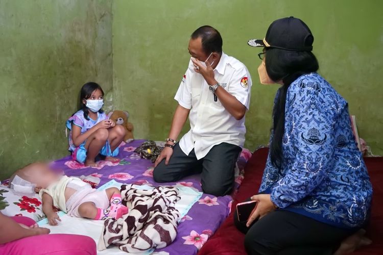 Wakil Wali Kota Surabaya Armuji saat melihat langsung kondisi bayi yang menderita hidrosefalus di Surabaya, Rabu (17/11/2021).