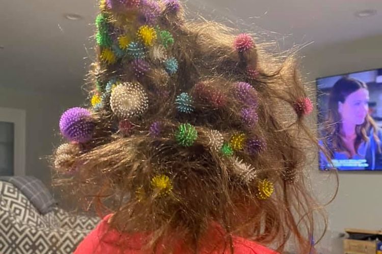 150 mainan yang tersangkut di rambut Abigail, anak perempuan Lisa Tschirlig Hoelzle. Butuh 20 jam untuk melepas semuanya.