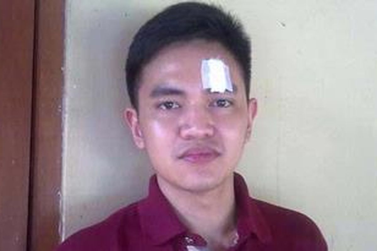 Andhika Mahatidana (24), korban pelemparan gelas yang diduga dilakukan Panji Trihatmodjo, cucu mantan Presiden RI Soeharto.
