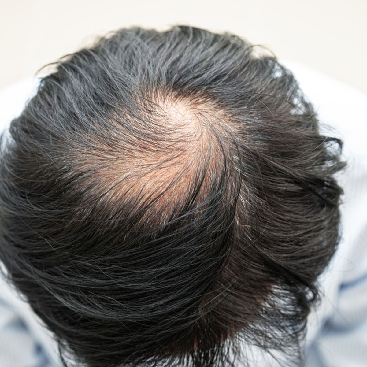Ilmuwan Temukan Serum Penumbuh Rambut dari Tanaman Pegagan