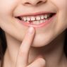 3 Cara Mengatasi Gigi Kecil