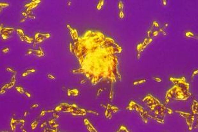Ilustrasi bakteri Clostridium botulinum