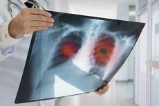 Ciri-ciri Penderita Penyakit Paru-paru Kronis hingga Akhir Kehidupan