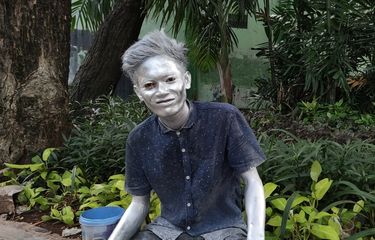 Kisah Manusia Silver Bertahan di Tengah Pandemi: Kulit Iritasi ...