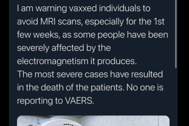 Tangkapan layar hoaks penerima vaksin Covid-19 tidak boleh scan MRI. Vaksin diklaim menghasilkan gelombang elektromagnetik yang dapat mengganggu prosedur MRI dan bahkan menyebabkan kematian.