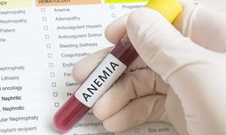Bisa Perburuk Kondisi bila Terpapar Covid-19, Berikut Cara Mencegah Anemia 