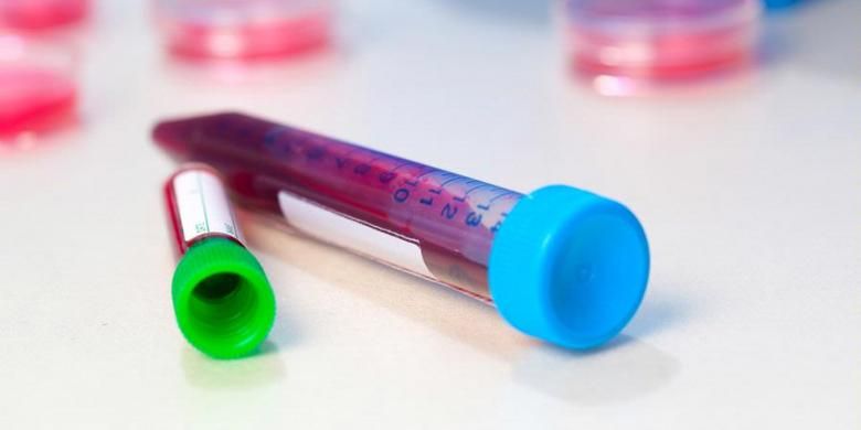 Masihkah Donor Universal Berlaku