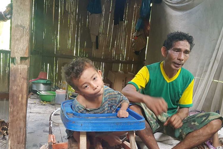 Seorang bocah sudah 7 tahun lumpuh di Manggarai Timur, NTT, Jumat, (26/11/2020). (KOMPAS.com/MARKUS MAKUR)