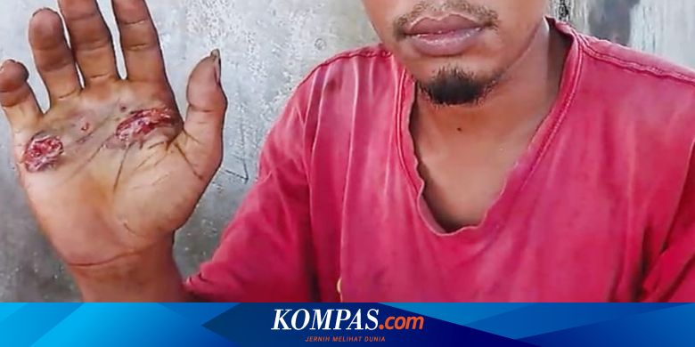 Pria Ini Dihukum Pegang Besi Panas karena Tuduhan Bersetubuh dengan Seorang Wanita