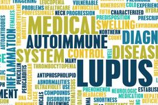 Menghadapi Penyakit Lupus dengan Sikap Positif
