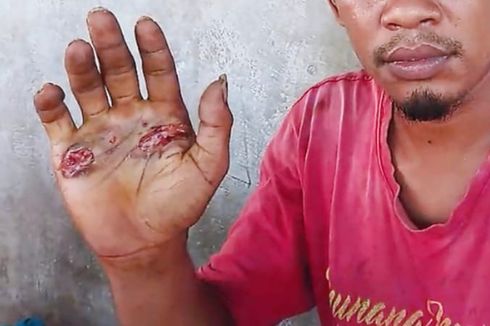 Buktikan Tak Bersetubuh dengan Seorang Perempuan, Sopir di Sikka Dipaksa Pegang Besi Panas, Ini Ceritanya