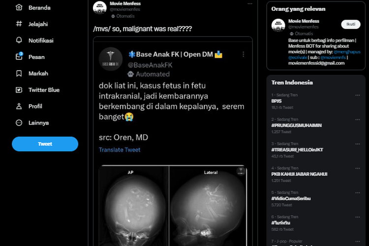 Apa Itu 