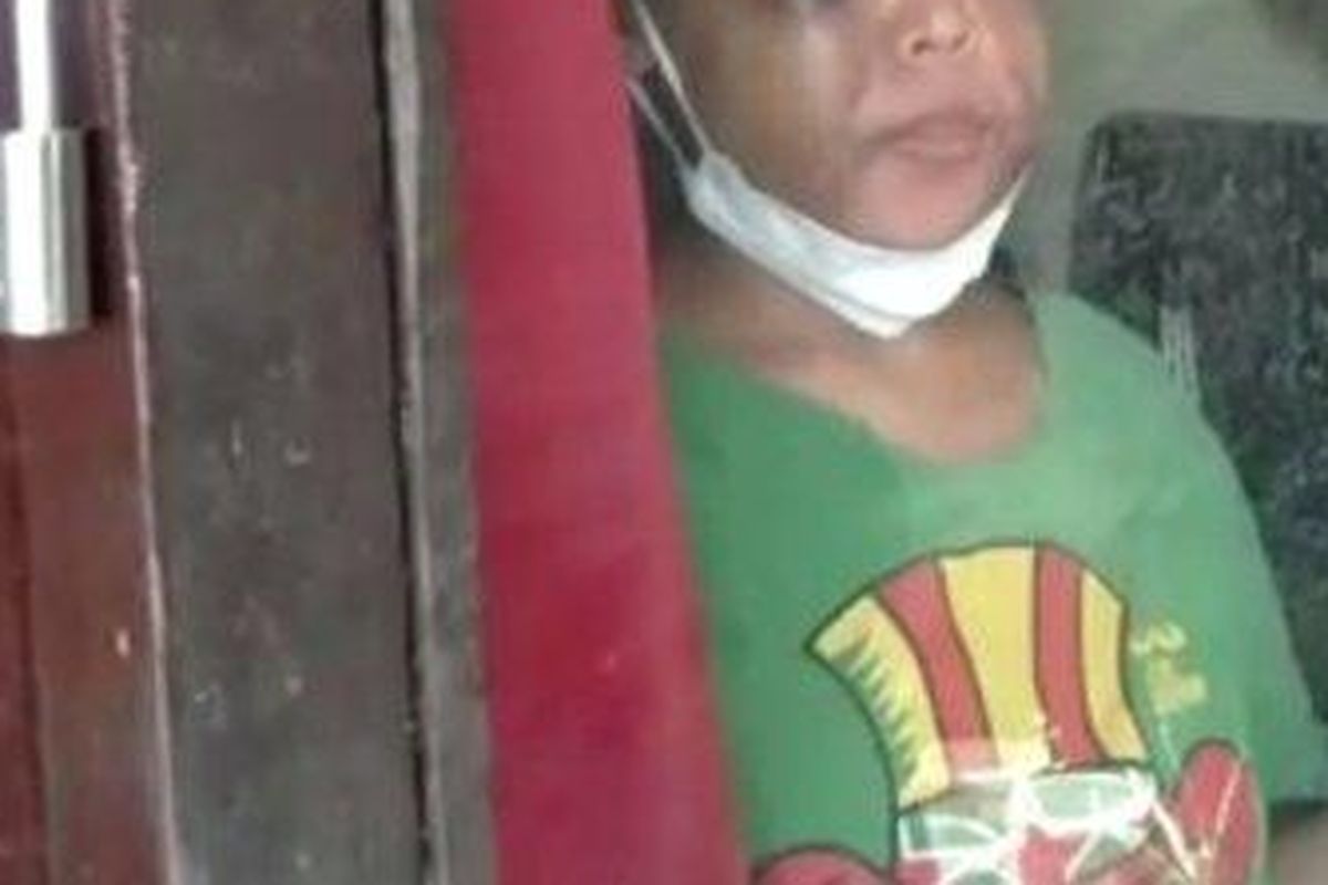 Seorang ART yang diduga disekap dan disiksa majikannya di Kabupaten Bandung Barat. 

