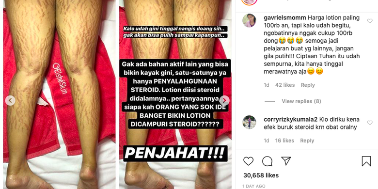 Efek Buruk Krim Kulit Abal Abal Tak Muncul Seketika Halaman All Kompas Com Efek Buruk Krim Kulit Abal Abal Tak Muncul Seketika Halaman All Kompas Com