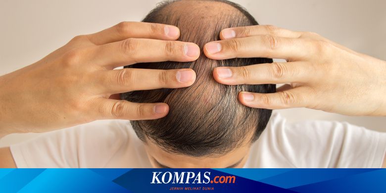 Mengatasi Kebotakan Dengan Menumbuhkan Rambut Mungkinkah Halaman All Kompas Com