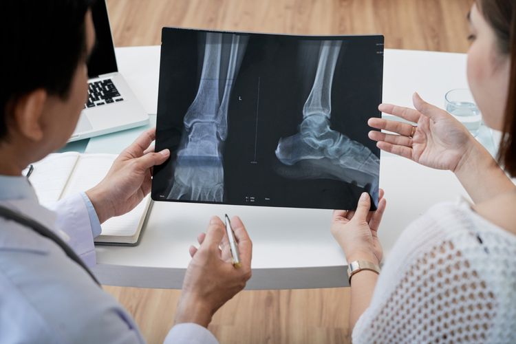 Osteosarkoma adalah kanker tulang primer yang sering dialami remaja. Kenali gejala dan penyebabnya menurut dokter.