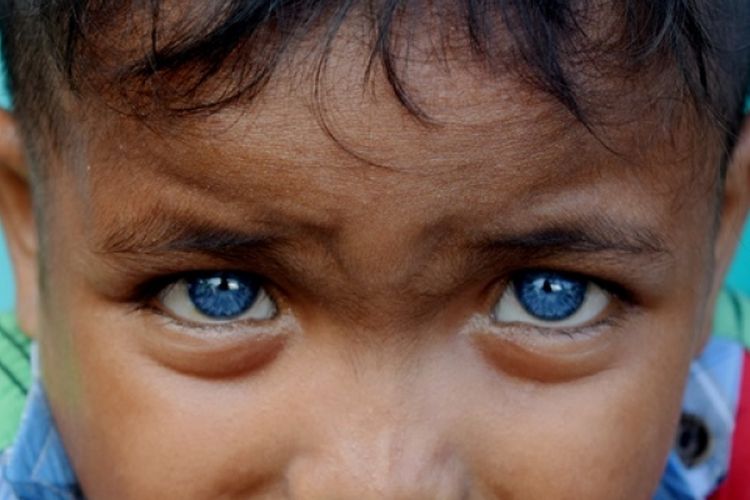 Seorang bocah di Desa Boneatiro, Kecamatan Kapuntori, Kabupaten Buton Sulawesi Tenggara,  Fardan Ramadhan (5), memiliki sepasang mata yang berwarna biru di kedua bola matanya. 