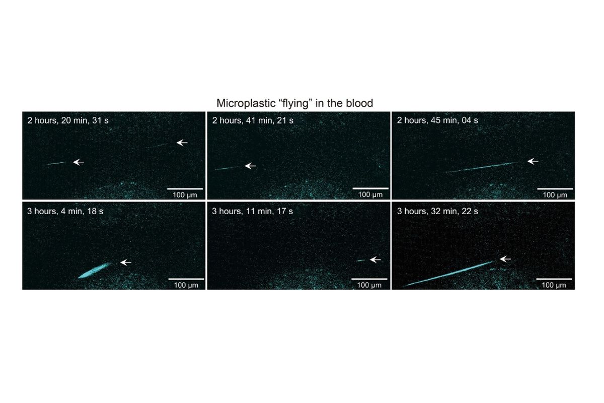 Mikroplastik terbukti bisa menyumbat pembuluh darah tikus. Pendaran menunjukkan mikroplastik pada pembuluh darah.