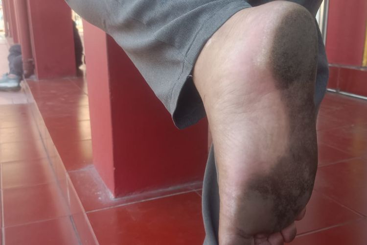 KCN Bantah Sebabkan Debu Batu Bara Menumpuk di Permukiman Cilincing Jakut