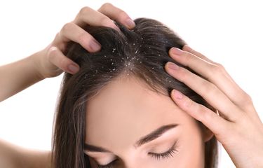 Salah satu penyebab timbulnya ketombe adalah adanya kondisi kulit tertentu, seperti eksim dan ringworm.