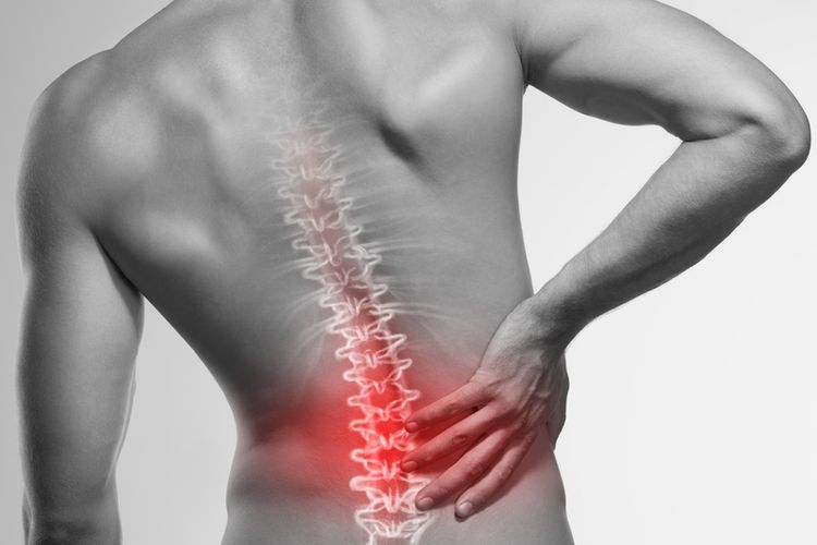 Ilustrasi tulang belakang yang berisiko mengalami skoliosis. Orang dengan skoliosis akan memiliki postur tubuh tidak normal karena terlihat seperti membentuk C atau S, jika dilihat dari belakang.
